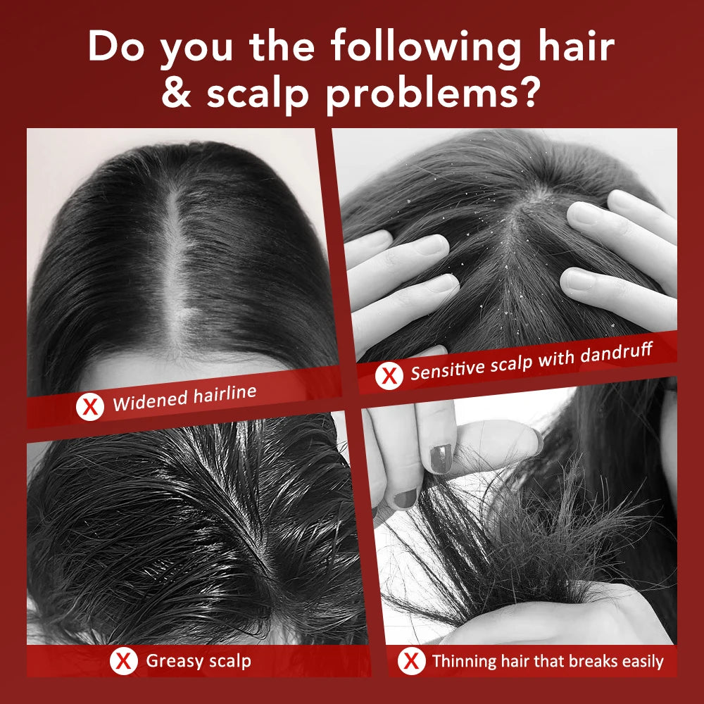 Red Light Therapy Scalp Massage Brush